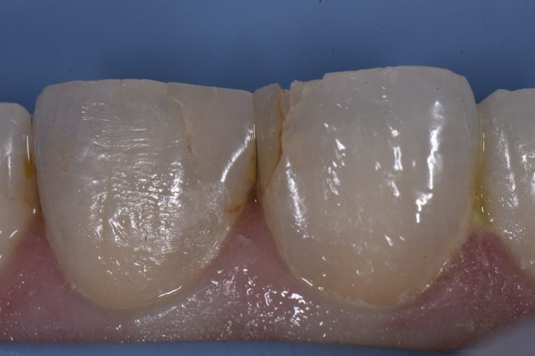 Expert Cosmetic Dentistry Find Best Cosmetic Dentists Auckland NZ