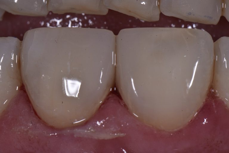 Expert Cosmetic Dentistry Find Best Cosmetic Dentists Auckland NZ