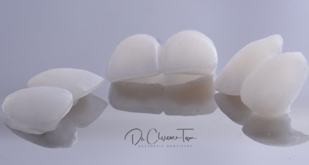 Testing Temporaries the Key to Success