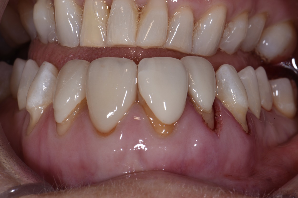 Modifying the Pink before Executing the White