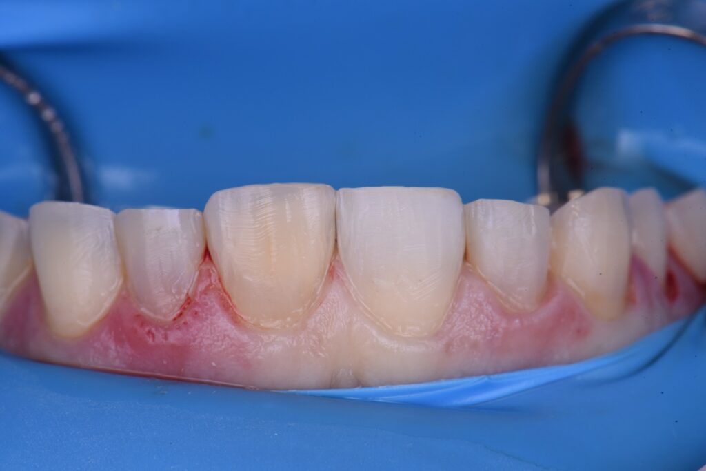 Cosmetic Dental Makeover New Zealand Cosmetic Dental Makeover New Zealand