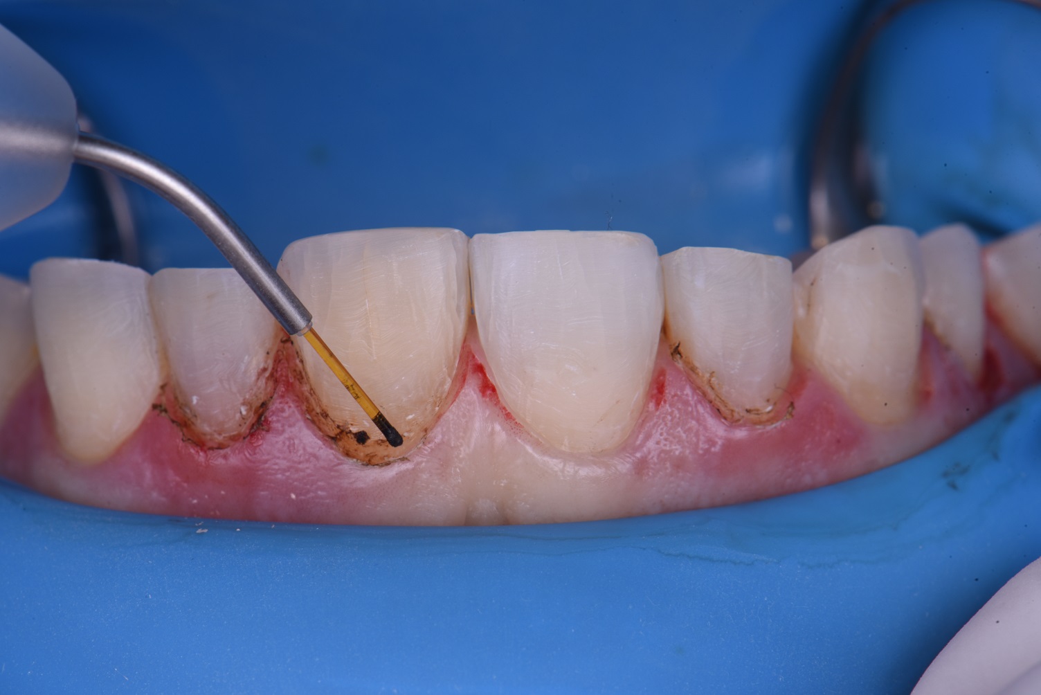 Cosmetic Dental Makeover New Zealand Cosmetic Dental Makeover New Zealand