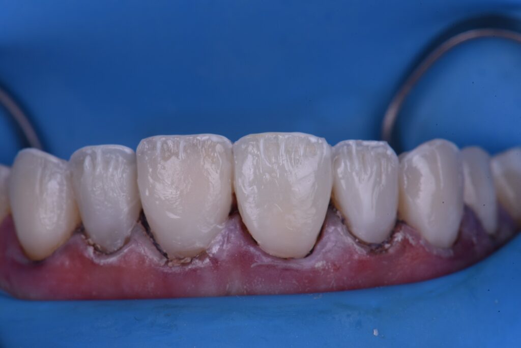 Cosmetic Dental Makeover New Zealand Cosmetic Dental Makeover New Zealand