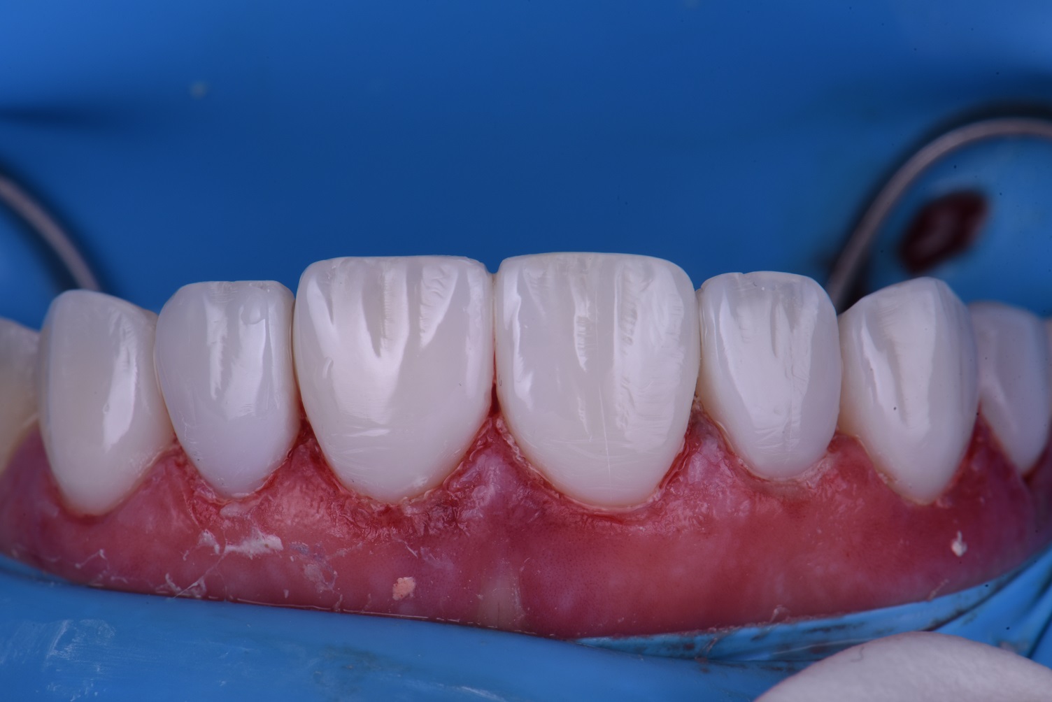 Cosmetic Dental Makeover New Zealand Cosmetic Dental Makeover New Zealand