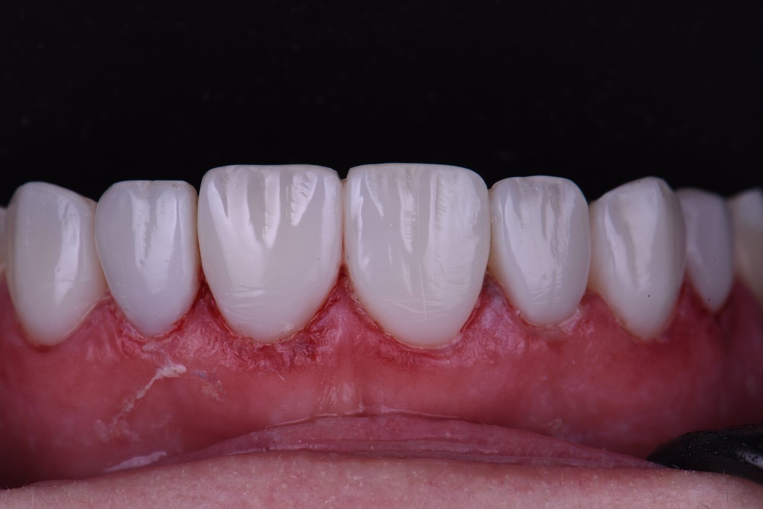 Cosmetic Dental Makeover New Zealand Cosmetic Dental Makeover New Zealand