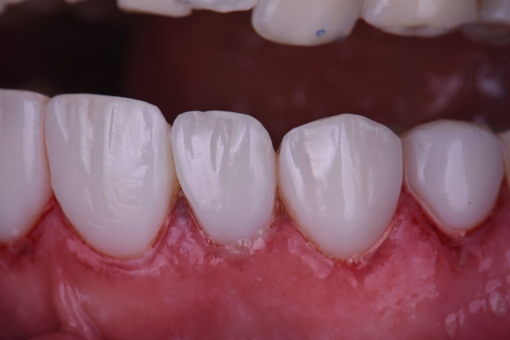 Cosmetic Dental Makeover New Zealand Cosmetic Dental Makeover New Zealand