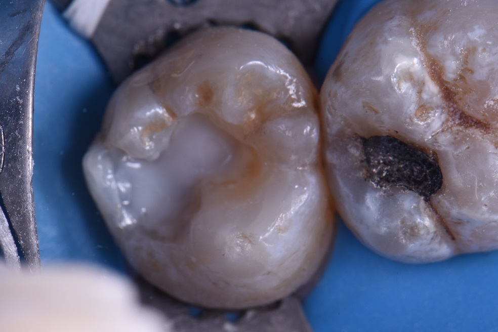 The Auckland Dentist for Auckland Dentists The Auckland Dentist for