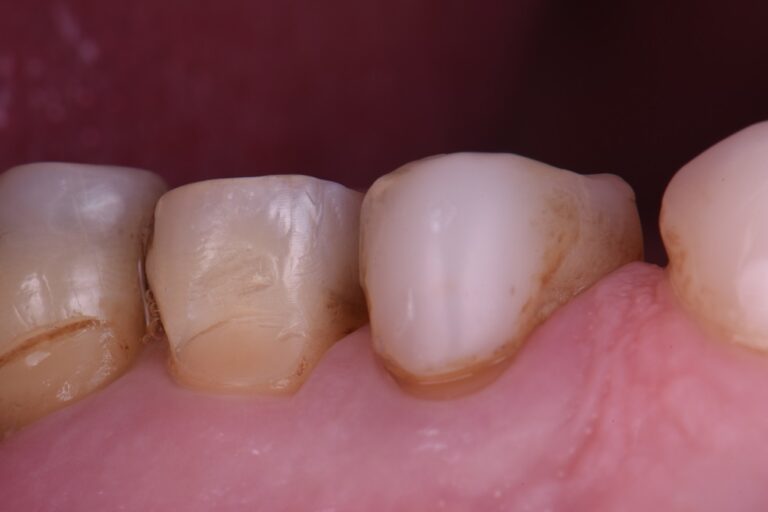 Universal Composites Universal Composites