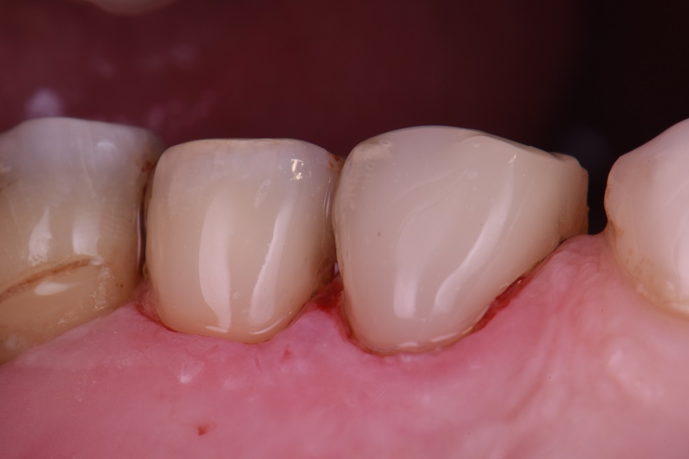 Universal Composites Universal Composites