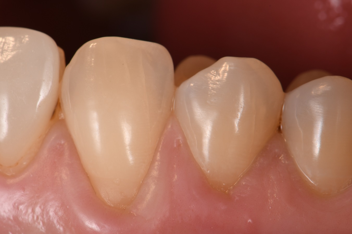 Eliminating root sensitivity Eliminating root sensitivity