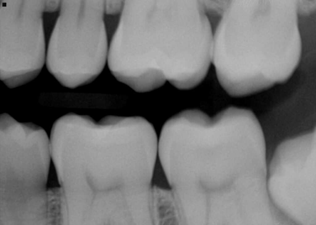 Sealants that don’t seal Beware