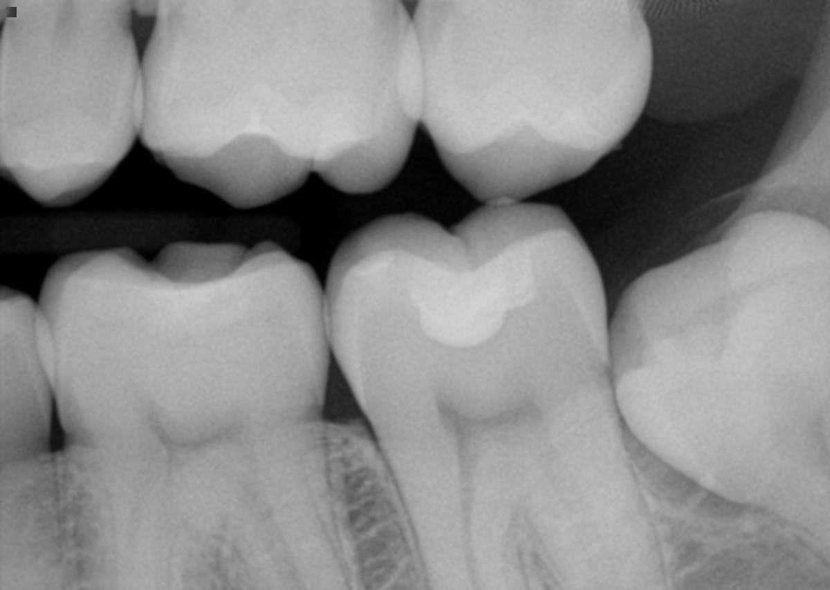 Sealants that don’t seal Beware