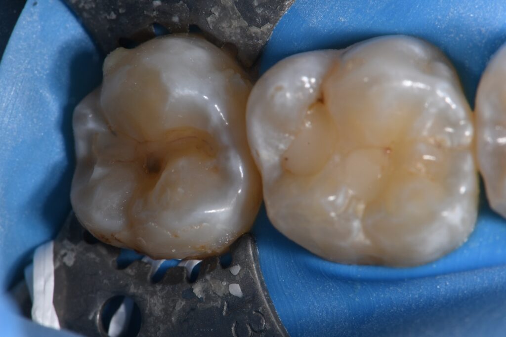 Chameleon Composite using ART Technology