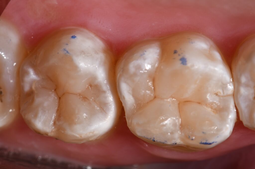 Chameleon Composite using ART Technology