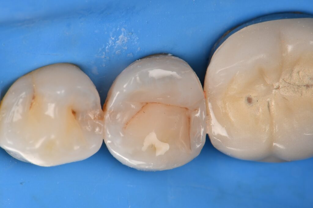 A jeweler examines a 3D-printed resin model, the precursor to a lost resin casting workflow.