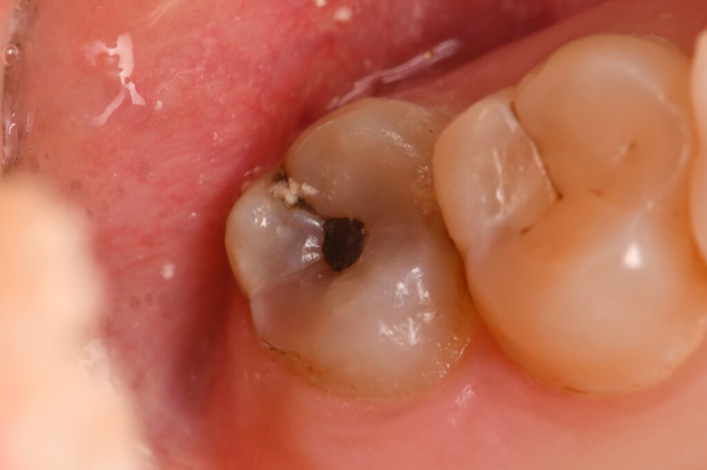Absolute Isolation is not always possible due to mechanical restrictions