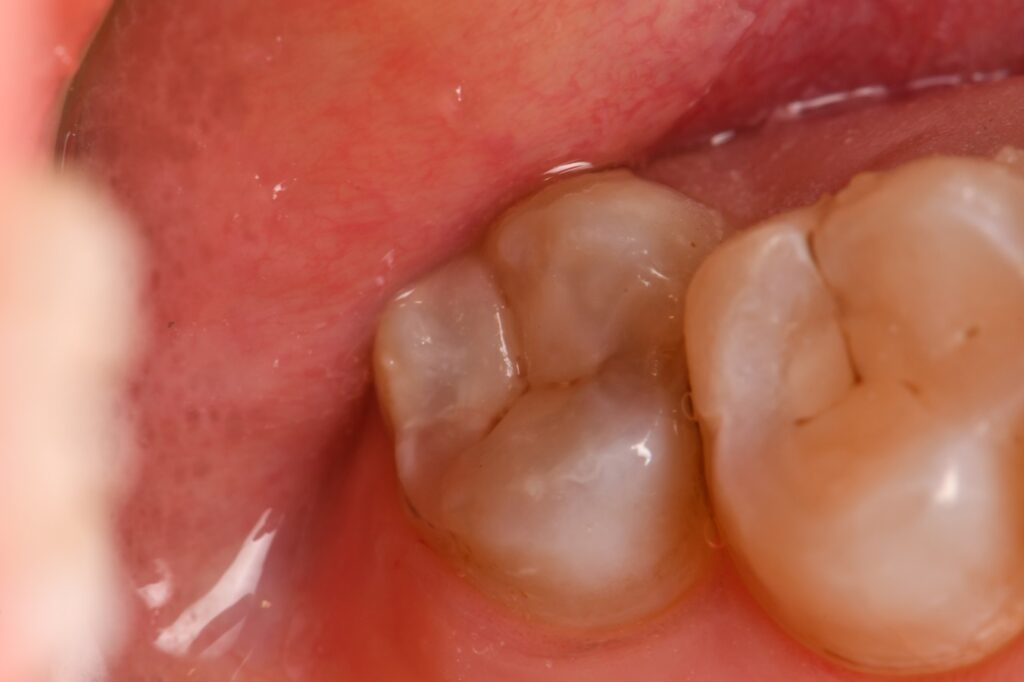 Absolute Isolation is not always possible due to mechanical restrictions