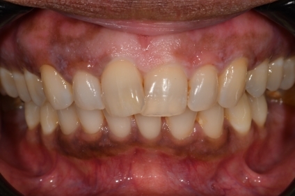 bna-sample